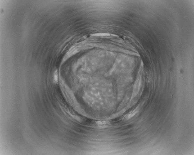 X0000061750095200512302249