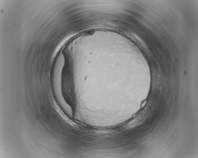 X0000061750796200512302236