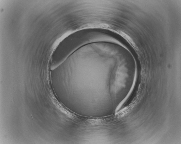 X0000061750854200512302236