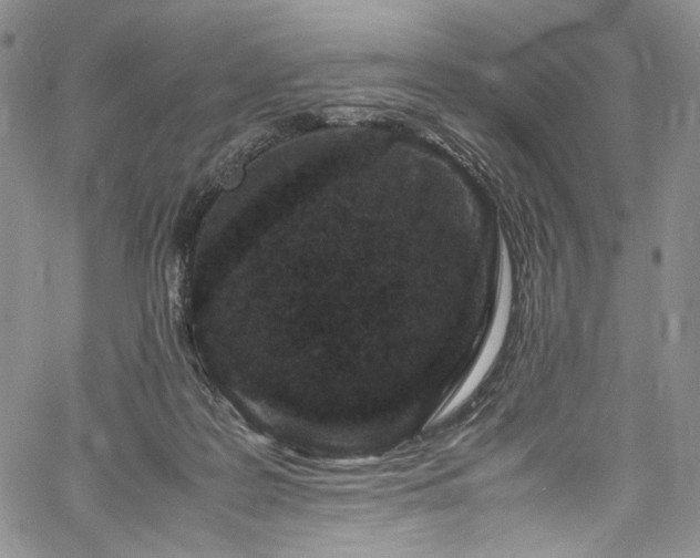 X0000061760219200512021518