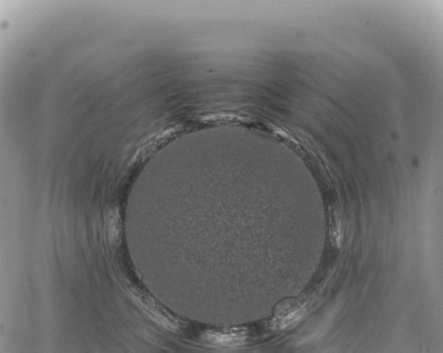 X0000061760563200512091704