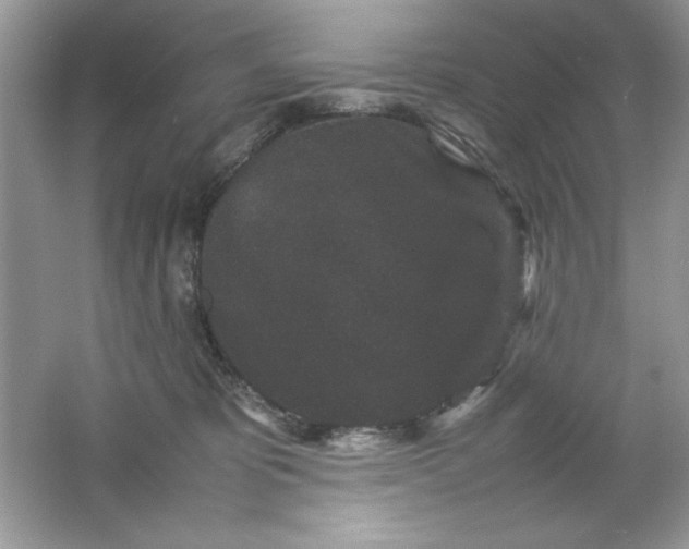 X0000061760325200512161750