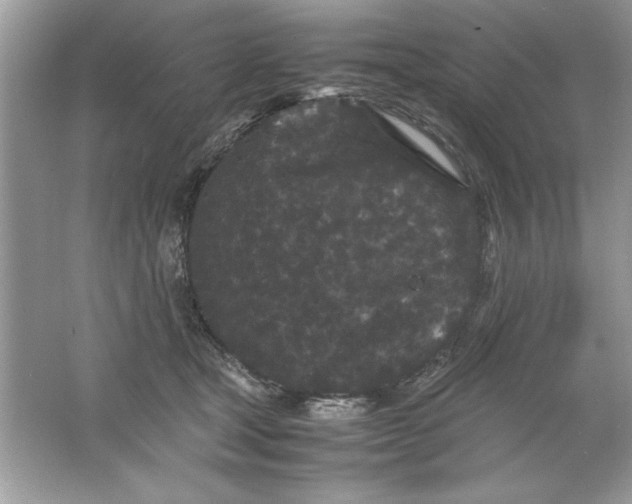 X0000061760465200512161748