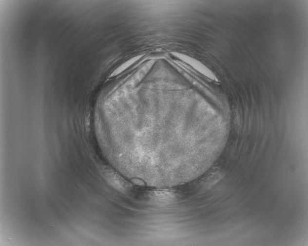 X0000061760668200512161745