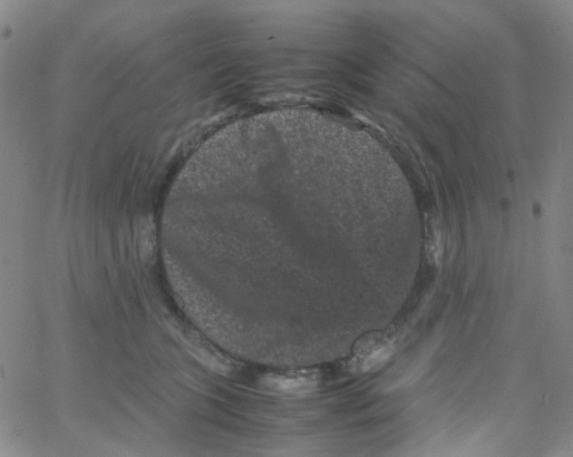 X0000061760563200512231554