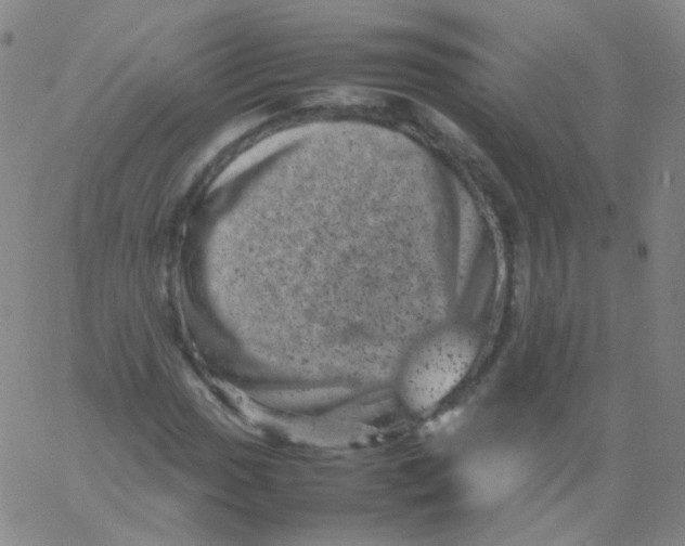 X0000061761017200512231545