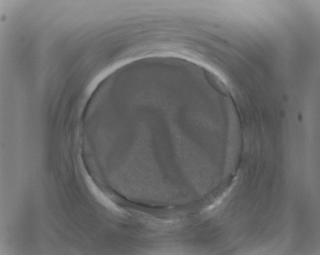 X0000061761526200512231538