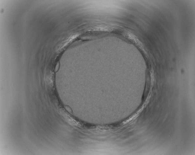 X0000061760305200512302310