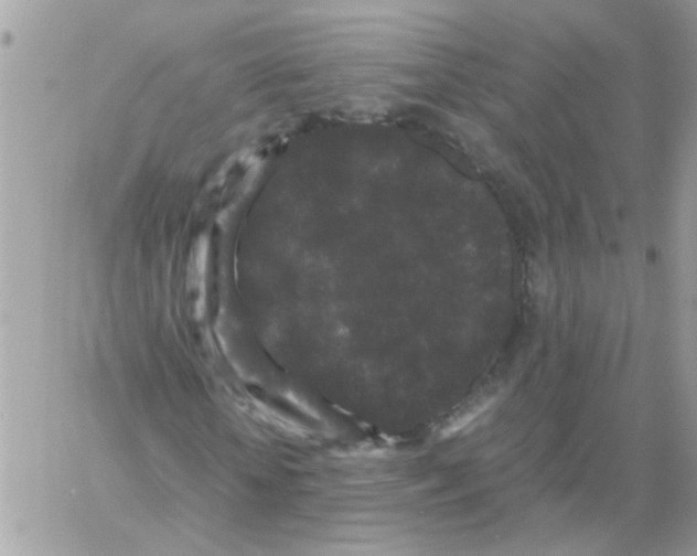 X0000061760818200512302301