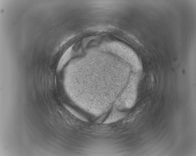 X0000061761158200512302256