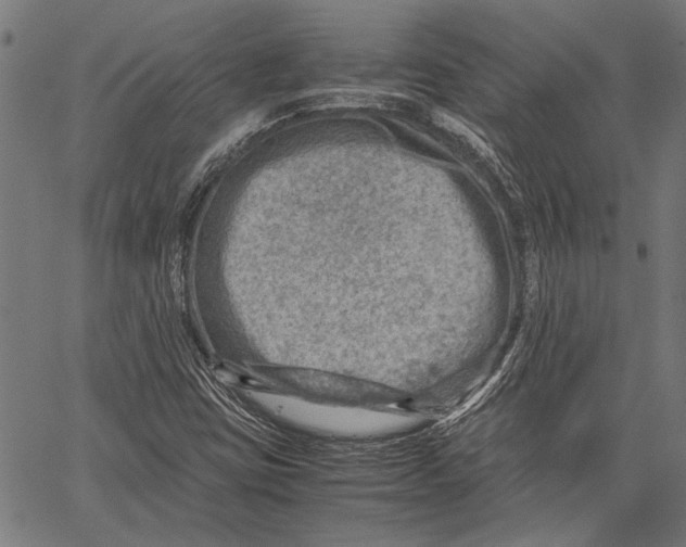 X0000062131403200601060845