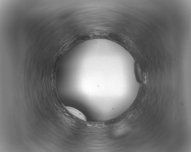 X0000062140915200512091013