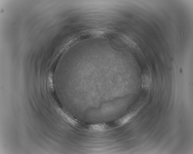 X0000062140238200512091223