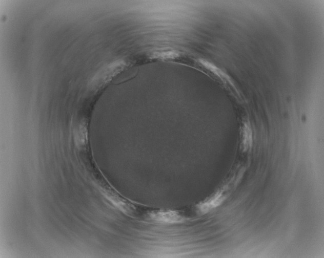 X0000062140517200512091218