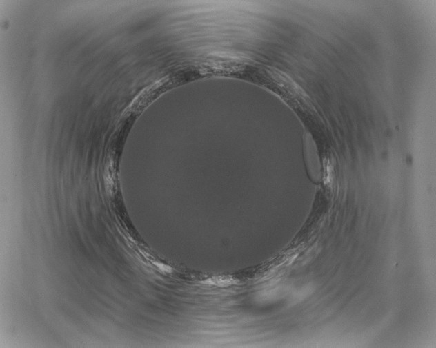 X0000062140915200512091211