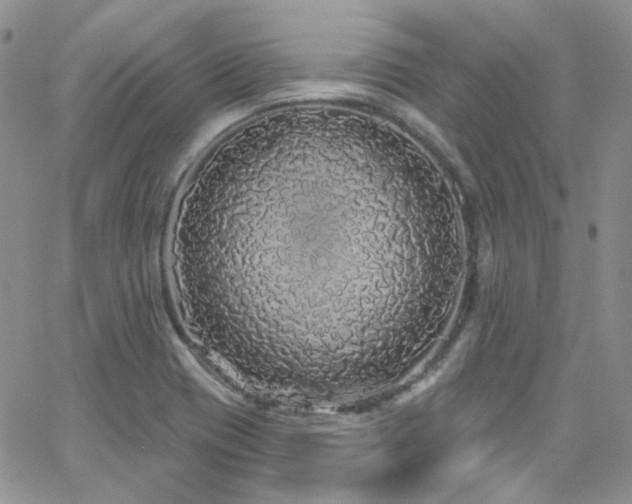 X0000062141417200512091203