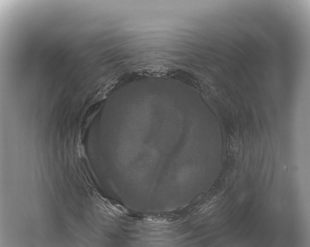 X0000062140818200512121239