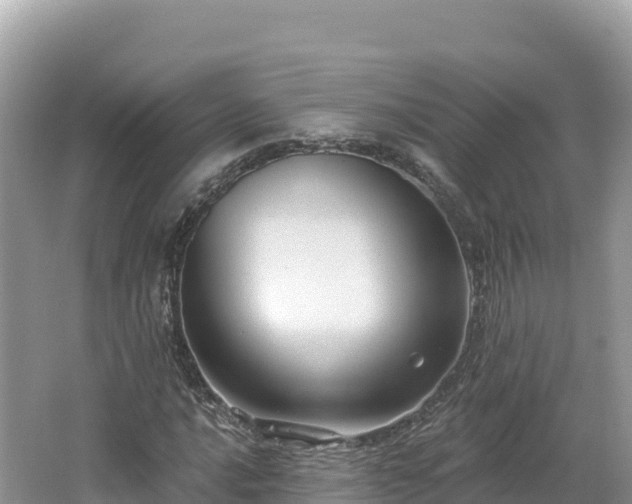 X0000062141016200512121236