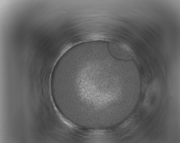 X0000062141039200512121236