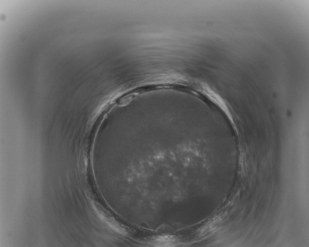 X0000062140059200512161228