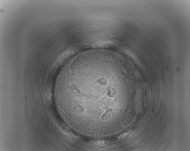 X0000062140687200512161218