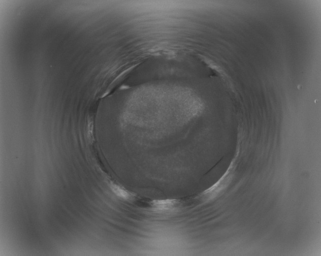 X0000062140192200512231515