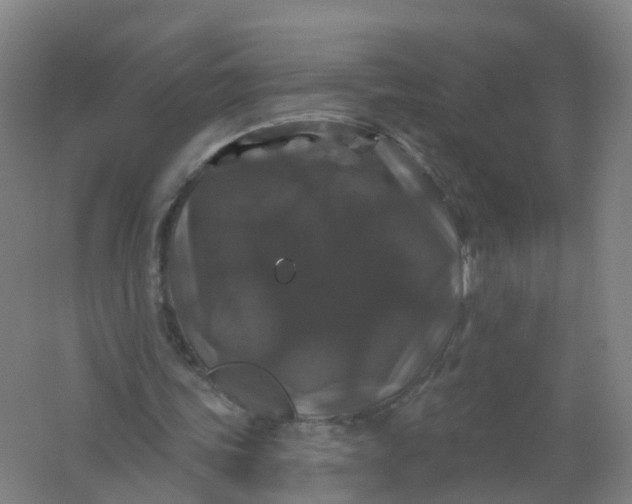 X0000062140339200512231511