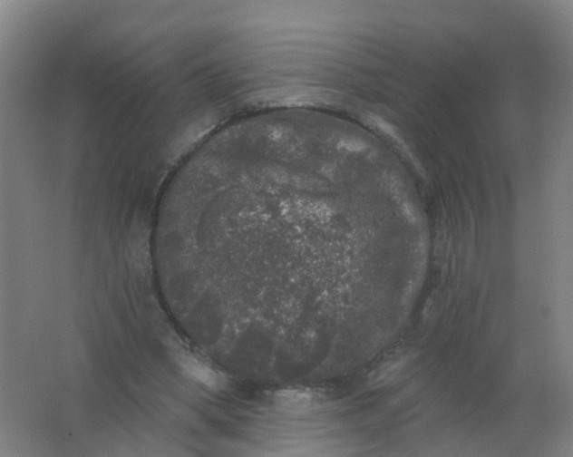 X0000062140394200512231511