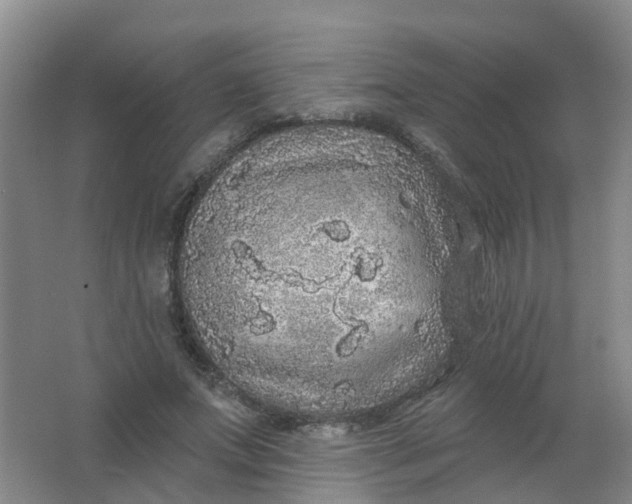 X0000062140687200512231505