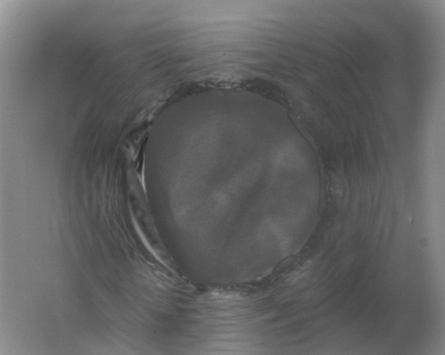 X0000062140818200512231502