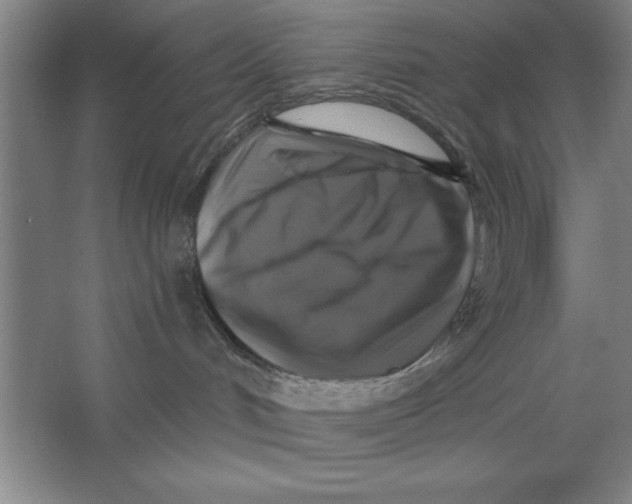 X0000062140048200512301538