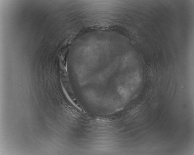 X0000062140818200512301525