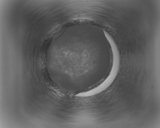 X0000062141014200512301522