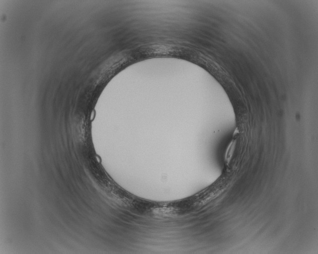 X0000062140216200601060931