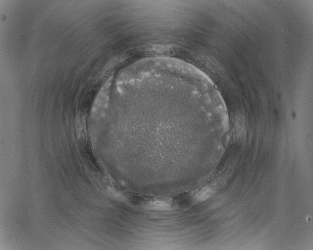 X0000062140236200601060931