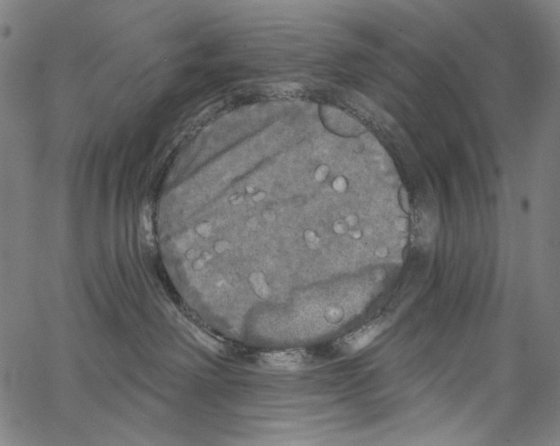 X0000062140238200601060931