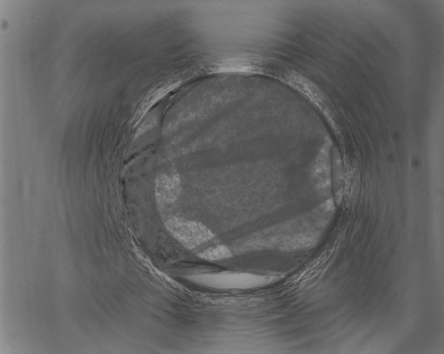 X0000062140385200601060929