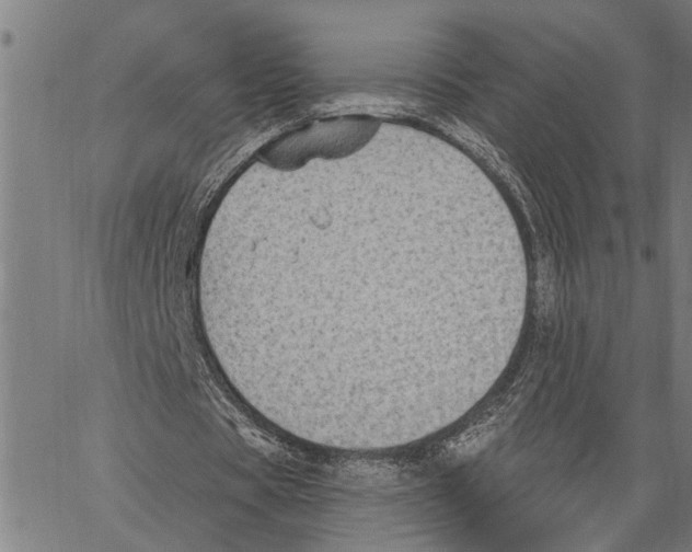 X0000062140529200601060925