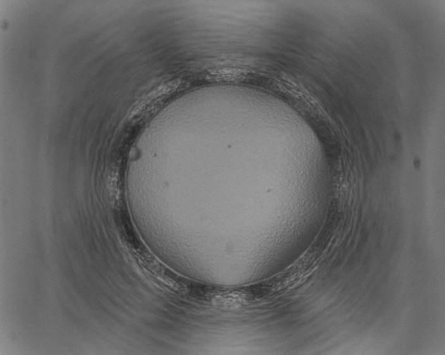 X0000062140599200601060925