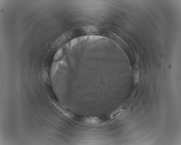 X0000062140618200601060925