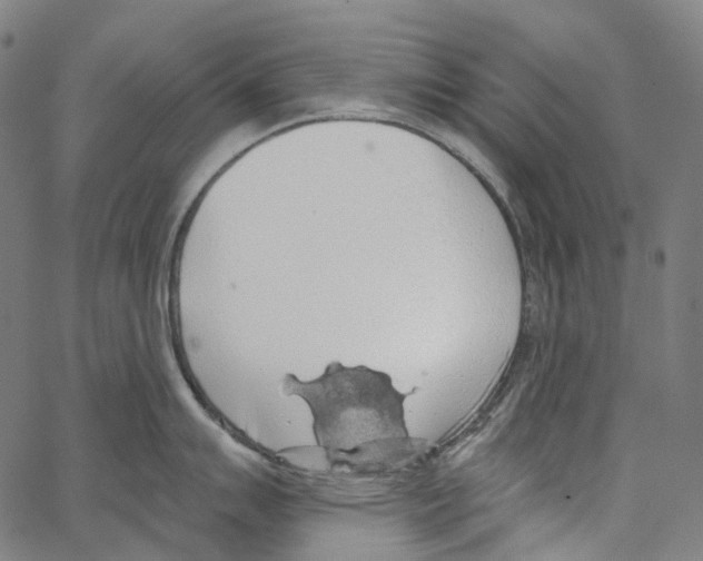 X0000062141007200601060918