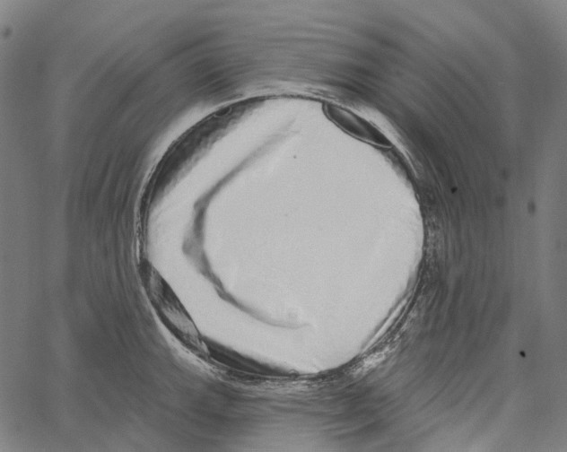 X0000062141143200601060916