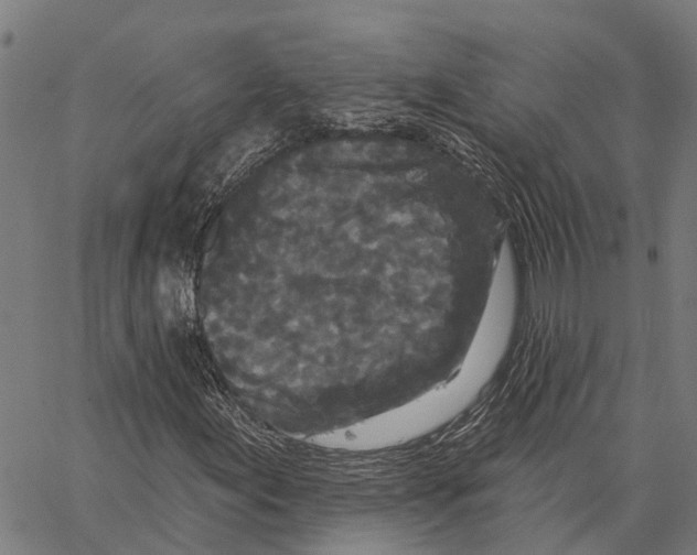 X0000062141155200601060916