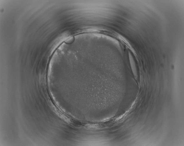 X0000062141194200601060915