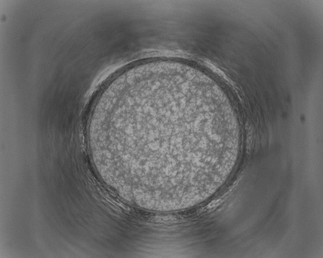 X0000062141215200601060914