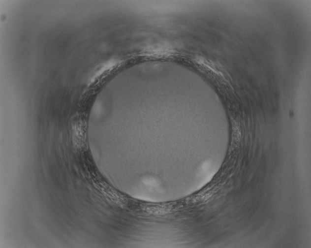 X0000062141254200601060914