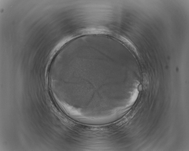 X0000062141419200601060911