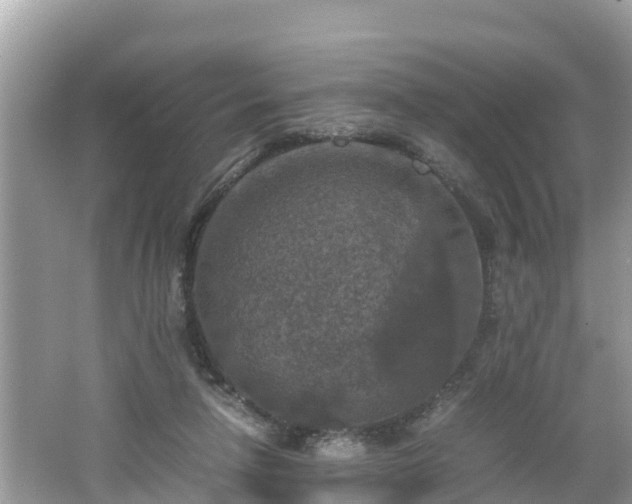 X0000062150258200512161242