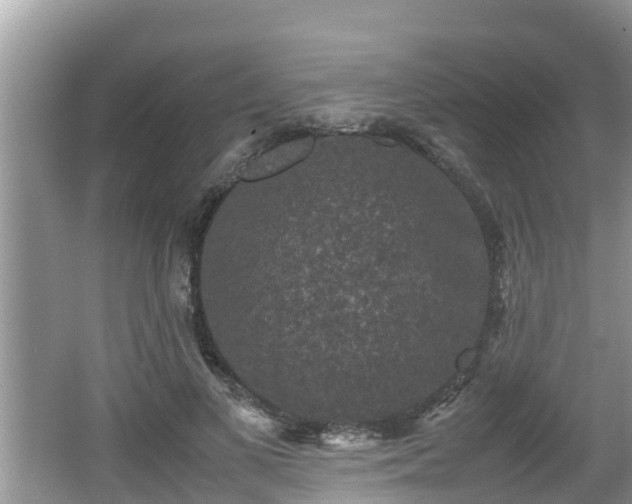 X0000062150693200512161235