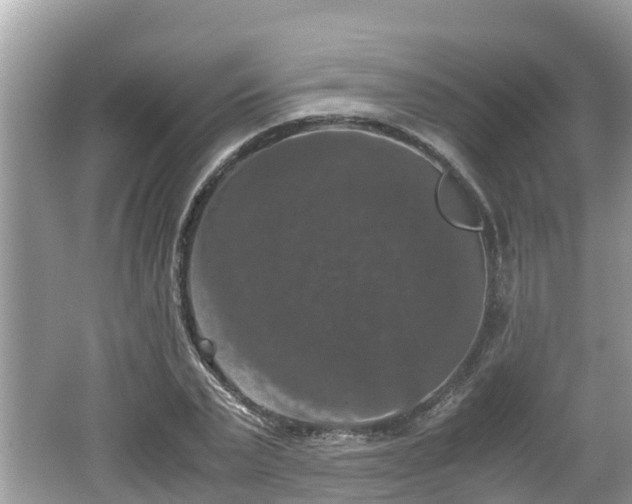 X0000062150783200512161233